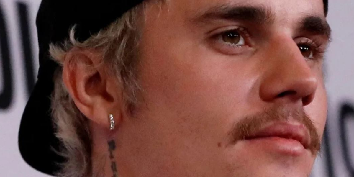 Justin Bieber berkata dia sedang berusaha untuk pulih daripada lumpuh separa muka