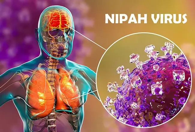 Virus Nipah Kekal Penyakit Keutamaan Dunia, Ini Sebabnya