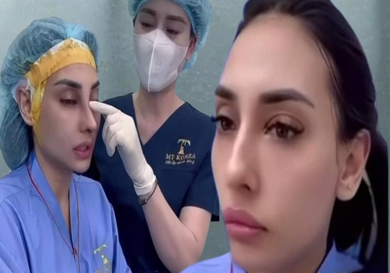 Silap Besar! Zarina Anjoulie Alami Jangkitan Serius Lepas Buat Hidung