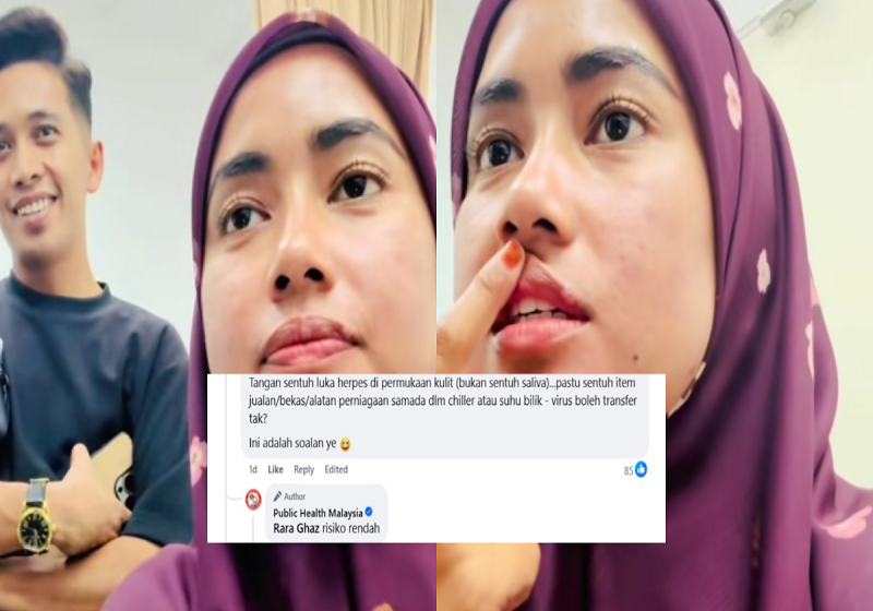 Kieda Crepe Positif Herpes? Ramai Mula Takut Nak Beli Produk!