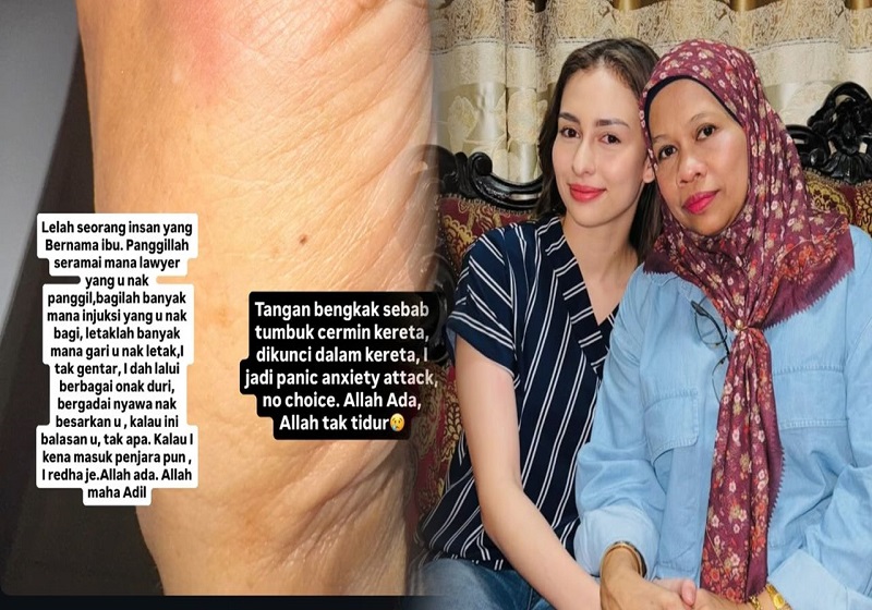 “Dah Macam Taraf Anjing Kurap Dah” – Ibu Anna Jobling