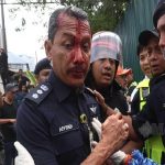ketua polis daerah dang wangi cedera