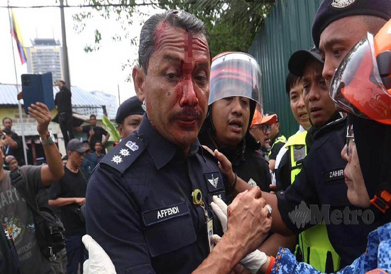 Polis KL Sahkan Tangkapan Selepas Ketua Polis Daerah Dang Wangi Cedera Diserang di Kampung Baru