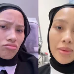 rawatan ketatkan faraj