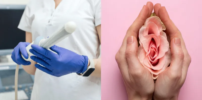 rawatan ketatkan faraj