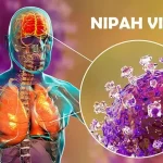 virus nipah