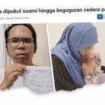 jururawat parah dipukul suami